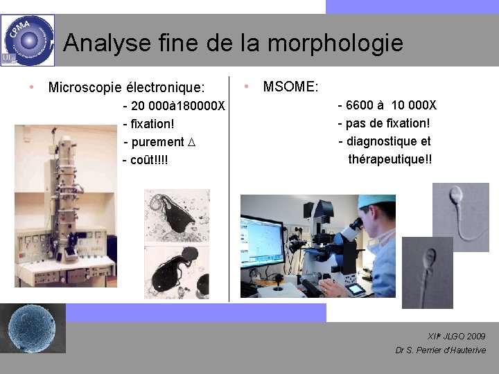 Analyse fine de la morphologie • Microscopie électronique: - 20 000à 180000 X -