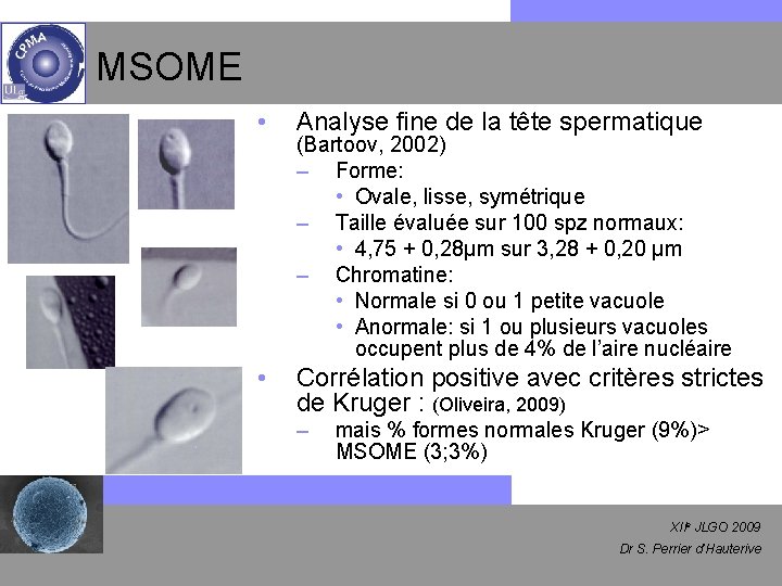 MSOME • Analyse fine de la tête spermatique • Corrélation positive avec critères strictes