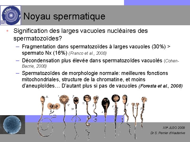 Noyau spermatique • Signification des larges vacuoles nucléaires des spermatozoïdes? – Fragmentation dans spermatozoïdes