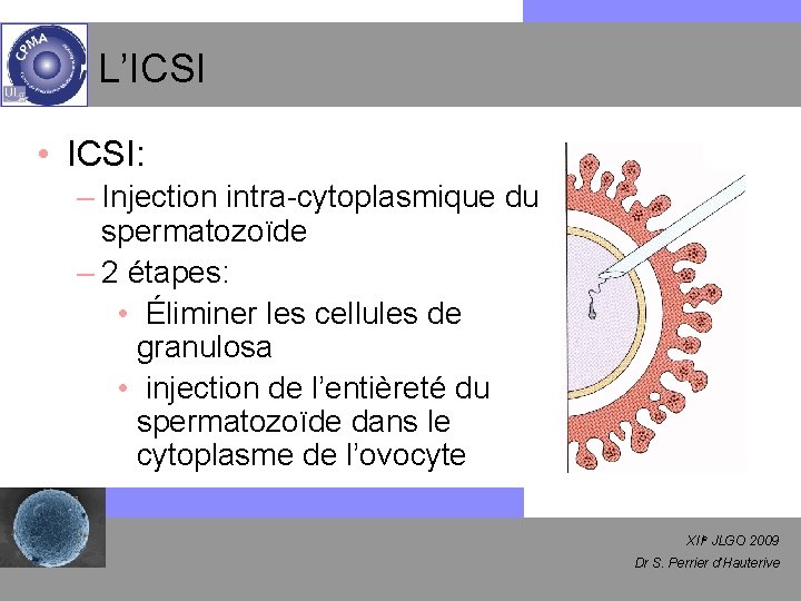 L’ICSI • ICSI: – Injection intra-cytoplasmique du spermatozoïde – 2 étapes: • Éliminer les