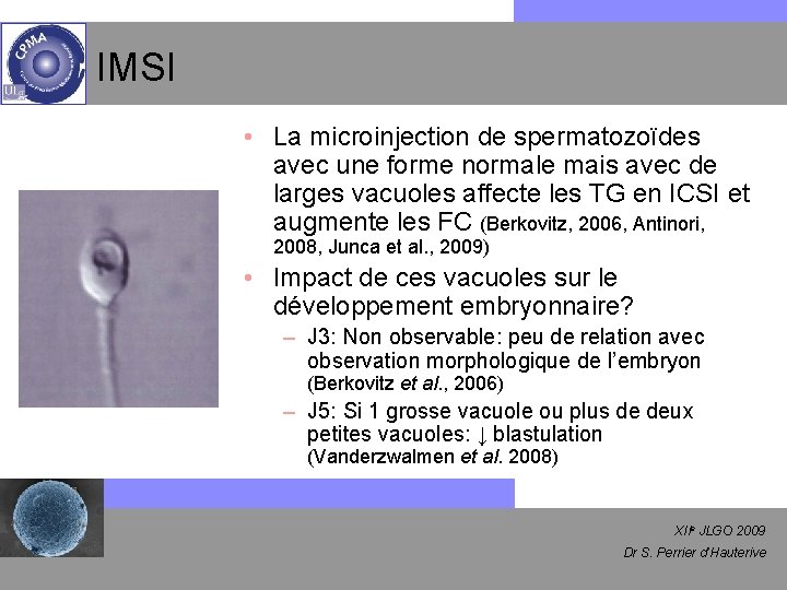 IMSI • La microinjection de spermatozoïdes avec une forme normale mais avec de larges