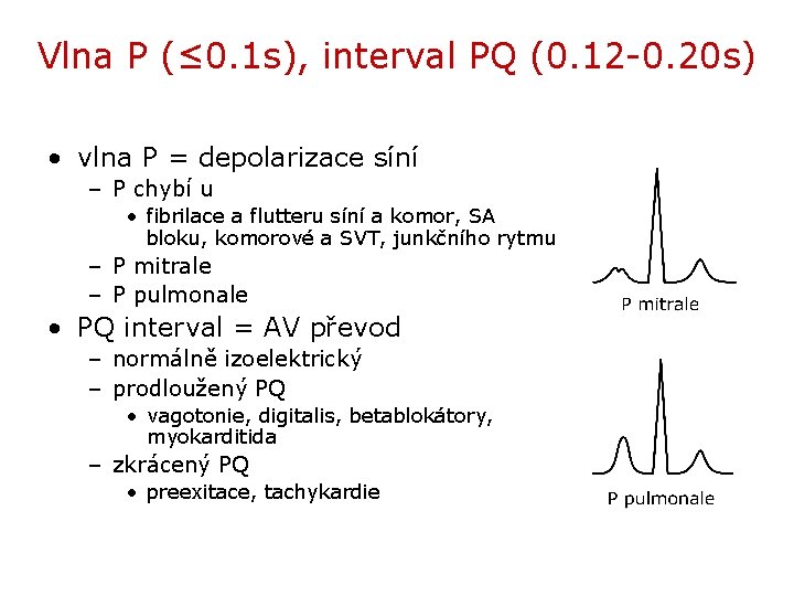 Vlna P (≤ 0. 1 s), interval PQ (0. 12 -0. 20 s) •