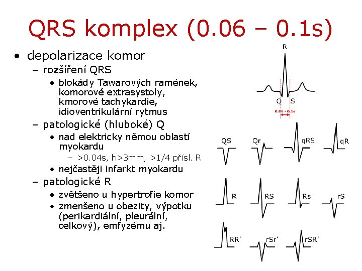 QRS komplex (0. 06 – 0. 1 s) • depolarizace komor – rozšíření QRS