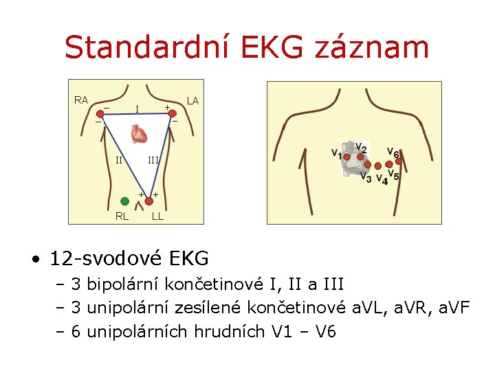 Standardní EKG záznam • 12 -svodové EKG – 3 bipolární končetinové I, II a