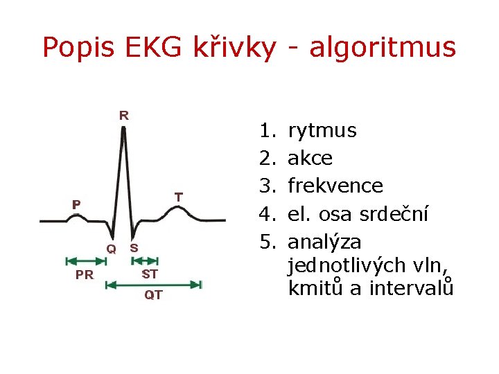 Popis EKG křivky - algoritmus 1. 2. 3. 4. 5. rytmus akce frekvence el.