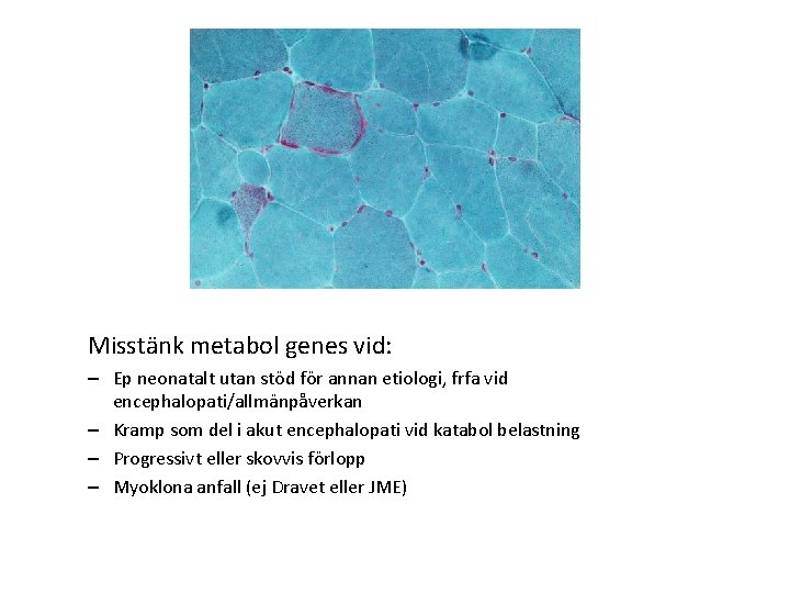 Misstänk metabol genes vid: – Ep neonatalt utan stöd för annan etiologi, frfa vid Misstänk metabol genes vid: – Ep neonatalt utan stöd för annan etiologi, frfa vid