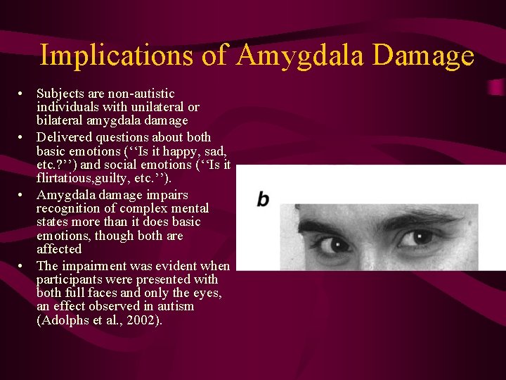 Implications of Amygdala Damage • Subjects are non-autistic individuals with unilateral or bilateral amygdala