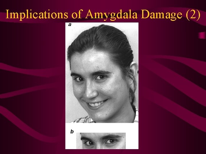 Implications of Amygdala Damage (2) 