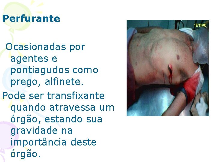 Perfurante Ocasionadas por agentes e pontiagudos como prego, alfinete. Pode ser transfixante quando atravessa