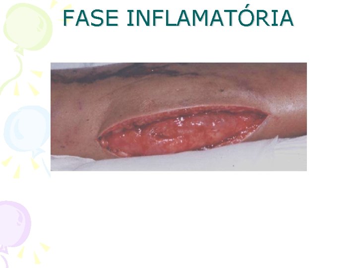 FASE INFLAMATÓRIA 