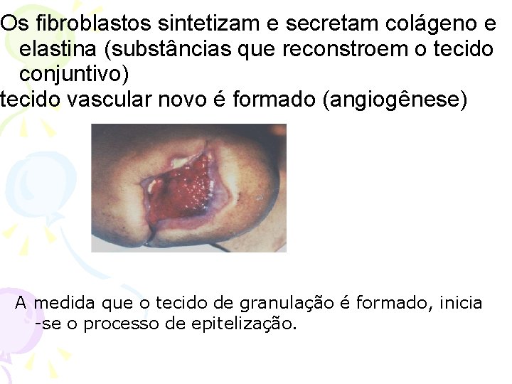 Os fibroblastos sintetizam e secretam colágeno e elastina (substâncias que reconstroem o tecido conjuntivo)