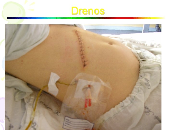 Drenos 