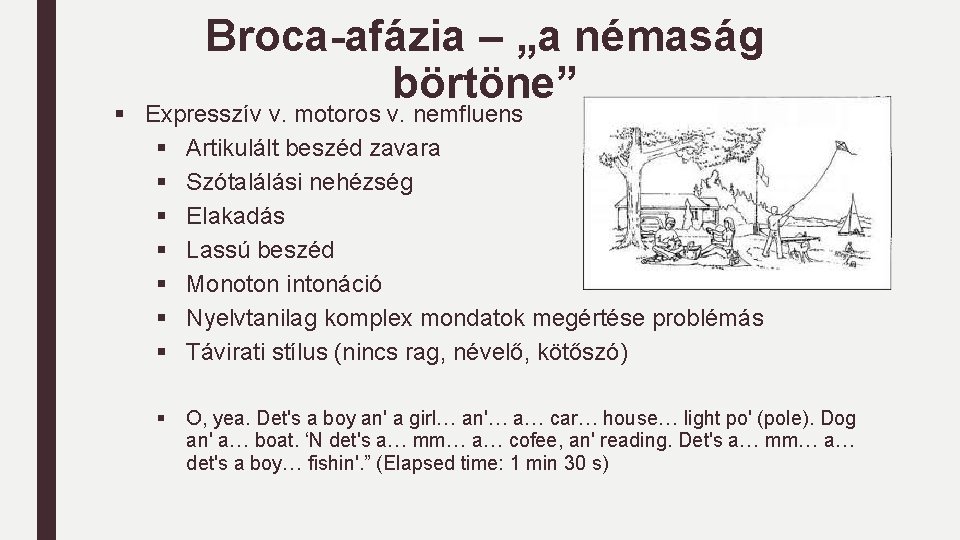 Broca-afázia – „a némaság börtöne” § Expresszív v. motoros v. nemfluens § Artikulált beszéd