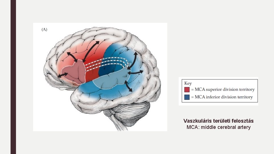 Vaszkuláris területi felosztás MCA: middle cerebral artery 