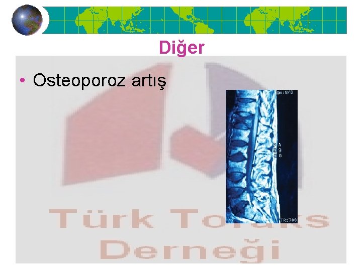 Diğer • Osteoporoz artış 