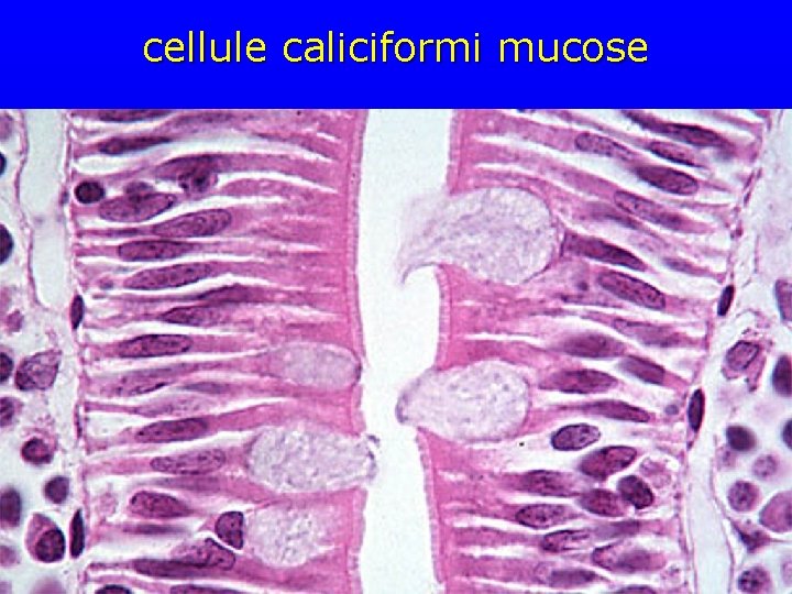 cellule caliciformi mucose 