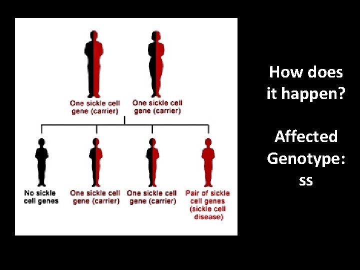 How does it happen? Affected Genotype: ss 