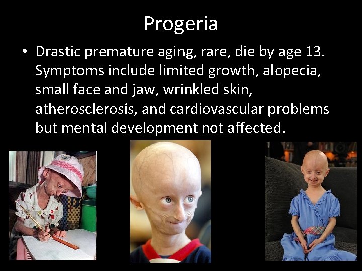 Progeria • Drastic premature aging, rare, die by age 13. Symptoms include limited growth,