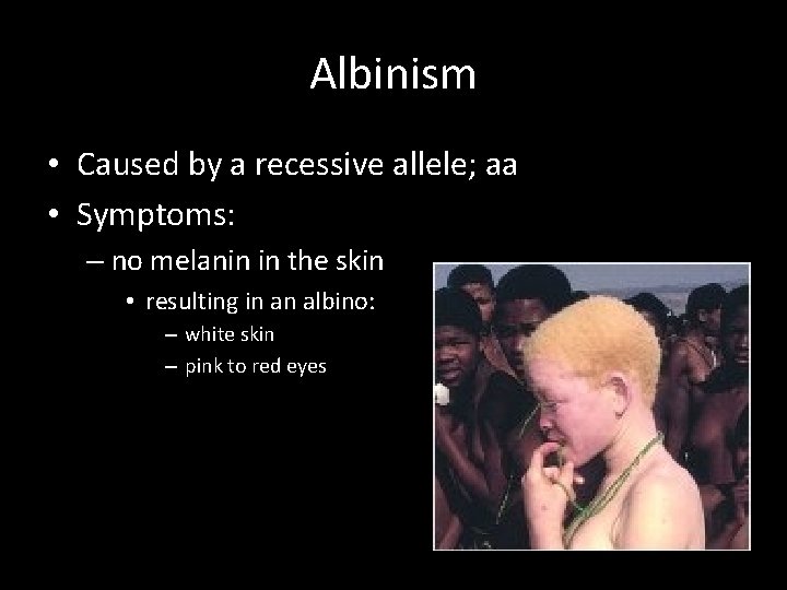 Albinism • Caused by a recessive allele; aa • Symptoms: – no melanin in