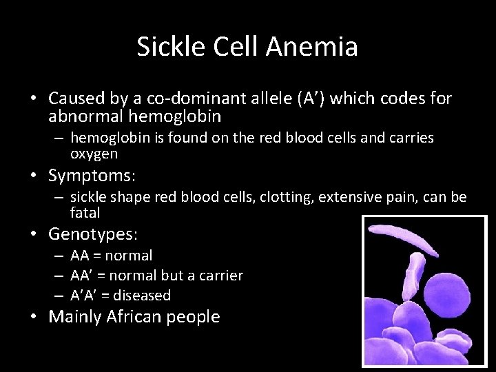 Sickle Cell Anemia • Caused by a co-dominant allele (A’) which codes for abnormal