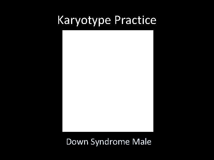 Karyotype Practice Down Syndrome Male 