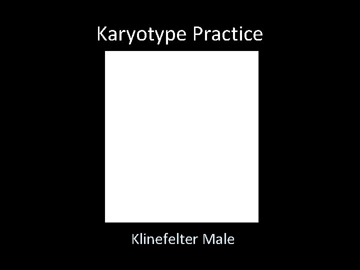 Karyotype Practice Klinefelter Male 