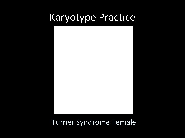 Karyotype Practice Turner Syndrome Female 