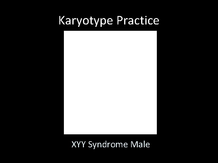 Karyotype Practice XYY Syndrome Male 