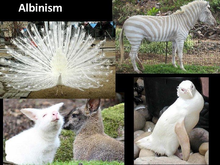 Albinism 