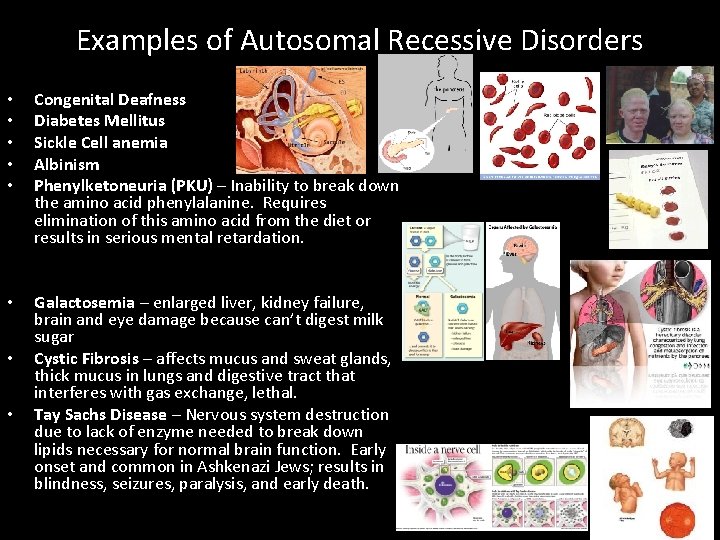 Examples of Autosomal Recessive Disorders • • • Congenital Deafness Diabetes Mellitus Sickle Cell