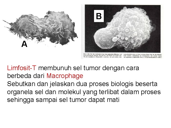 B A Limfosit-T membunuh sel tumor dengan cara berbeda dari Macrophage Sebutkan dan jelaskan