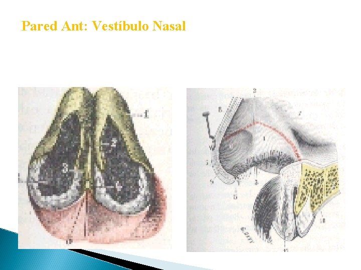 Pared Ant: Vestíbulo Nasal 