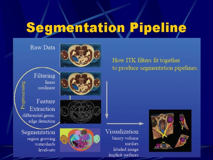 Segmentation Pipeline 