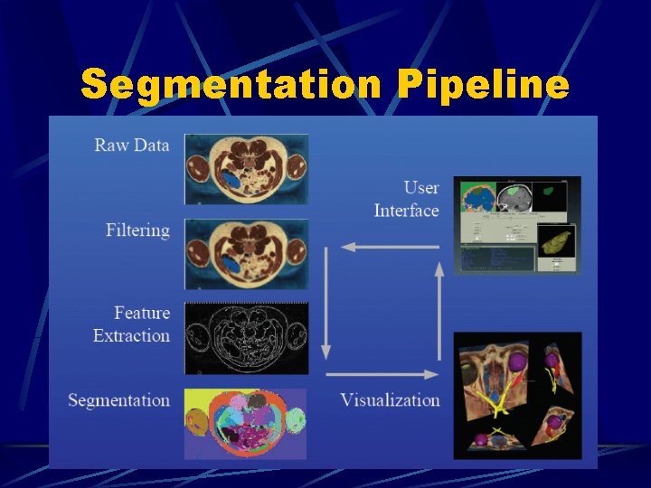 Segmentation Pipeline 