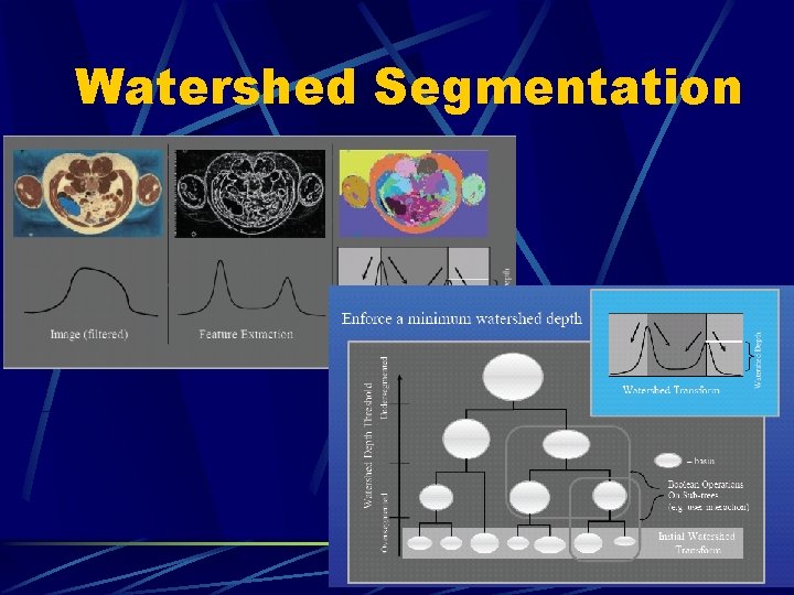 Watershed Segmentation 