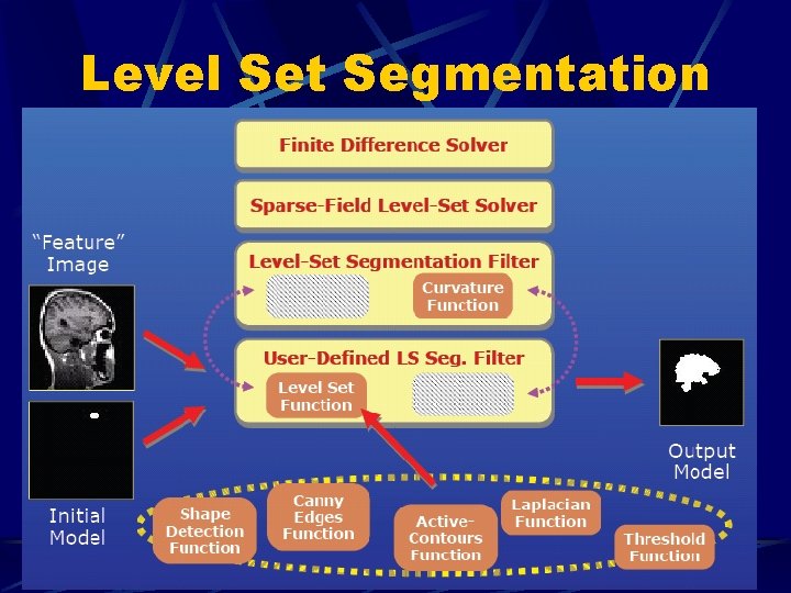 Level Set Segmentation 