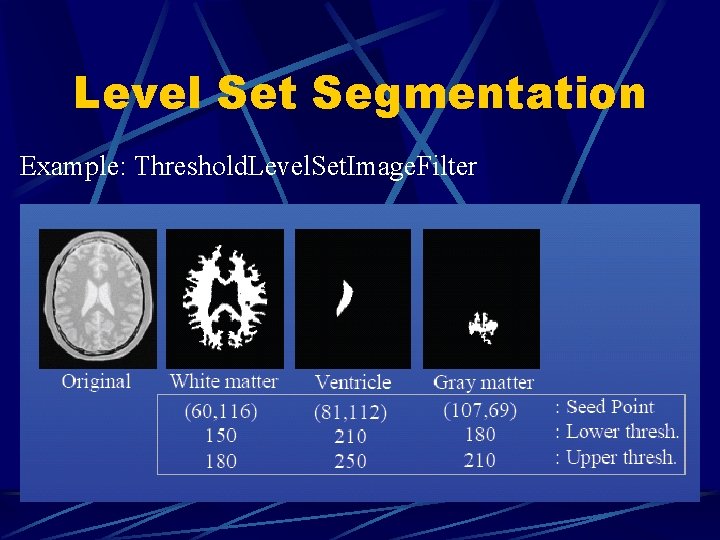 Level Set Segmentation Example: Threshold. Level. Set. Image. Filter 
