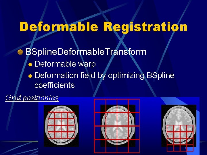 Deformable Registration BSpline. Deformable. Transform Deformable warp l Deformation field by optimizing BSpline coefficients