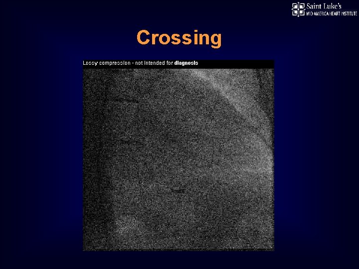 Crossing 