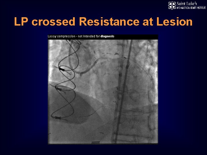 LP crossed Resistance at Lesion 