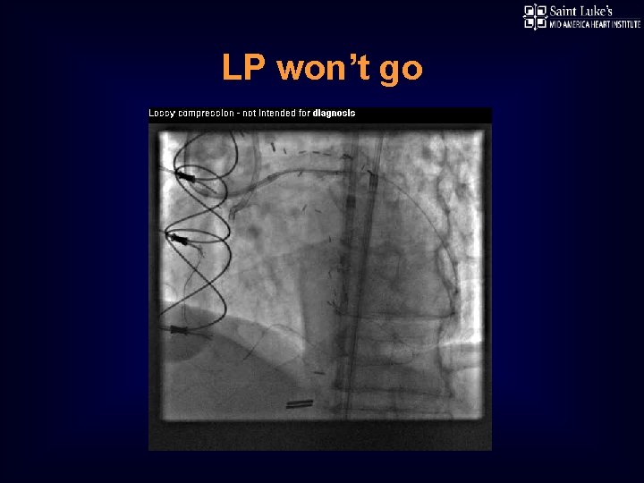 LP won’t go 