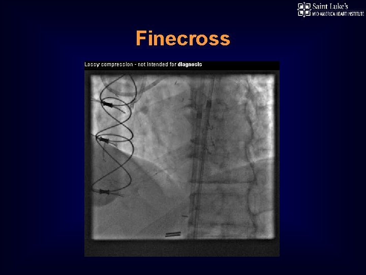 Finecross 