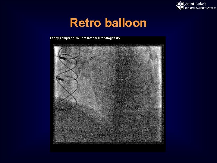 Retro balloon 