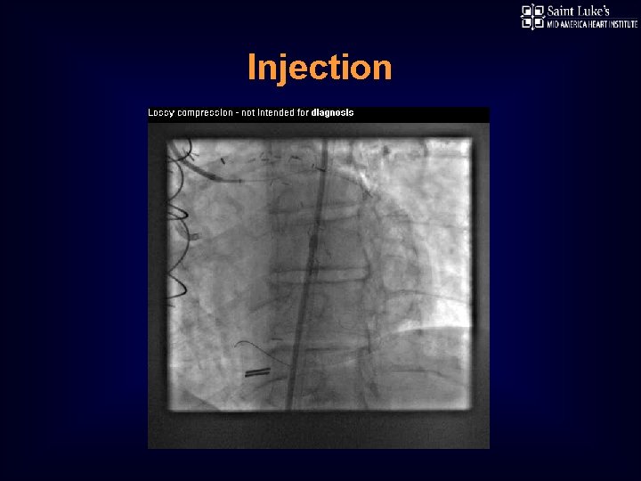Injection 