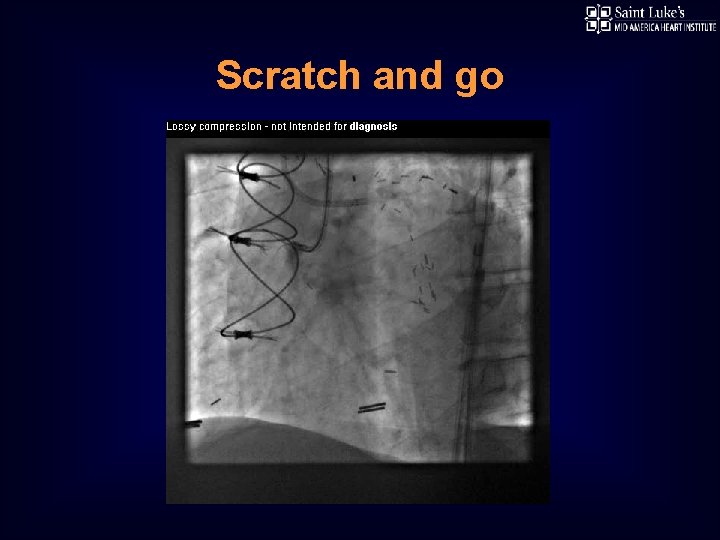 Scratch and go 