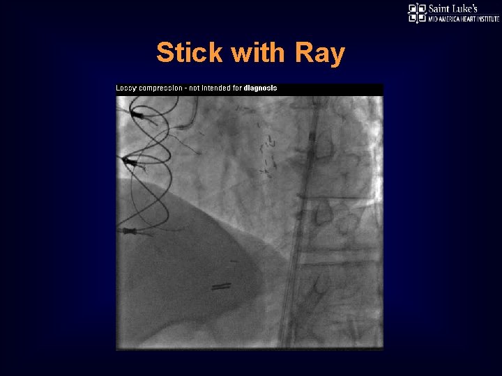Stick with Ray 