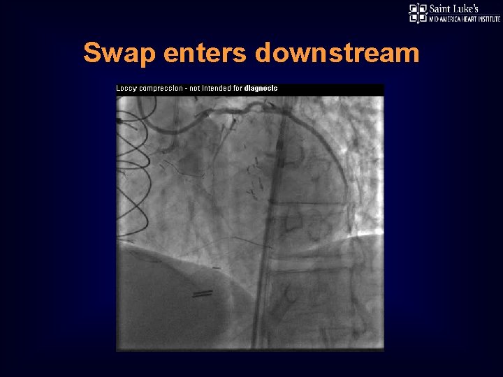 Swap enters downstream 