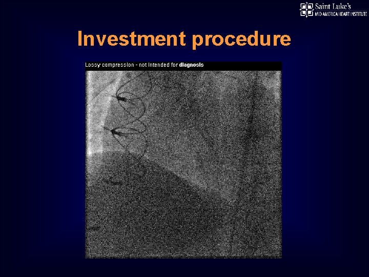 Investment procedure 