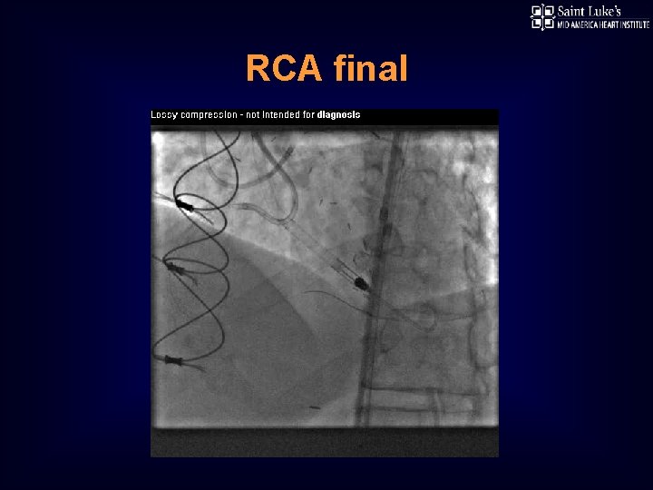 RCA final 