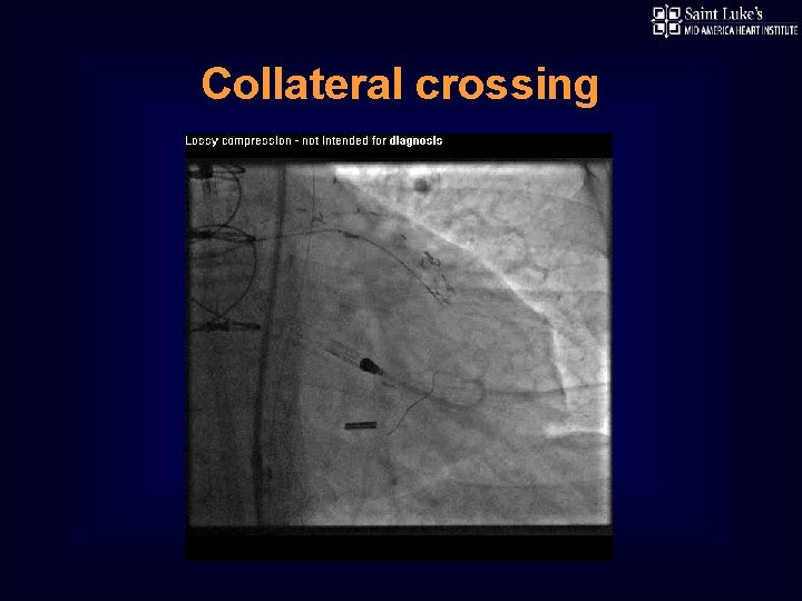 Collateral crossing 